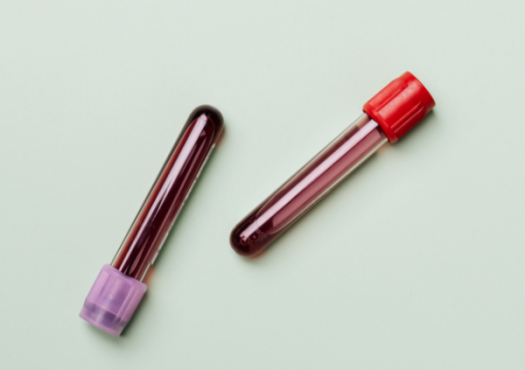 Prelievo di sangue durante donazione presso centro trasfusionale